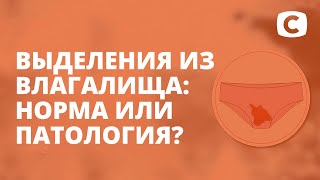 Выделения у женщин: норма и патология – Я стесняюсь своего тела