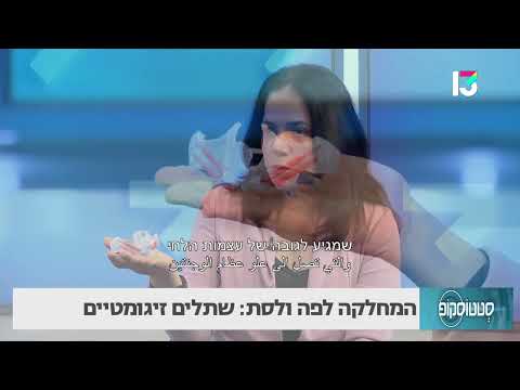 שתלים זיגומטיים: המחלקה לפה ולסת 