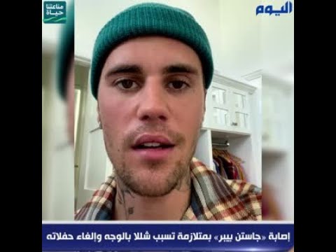 إصابة «جاستن بيبر» بمتلازمة تسبب شللا بالوجه وإلغاء حفلاته