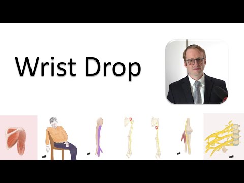 Wrist Drop and the Radial Nerve