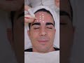 ASMR Chinese Facial Massage For Glowing Skin Shorts