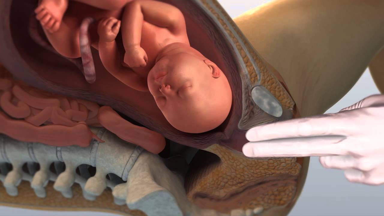 Watch Now Andrea Di Lieto parto spontaneo 3D Andrea Di Lieto parto spontaneo 3D