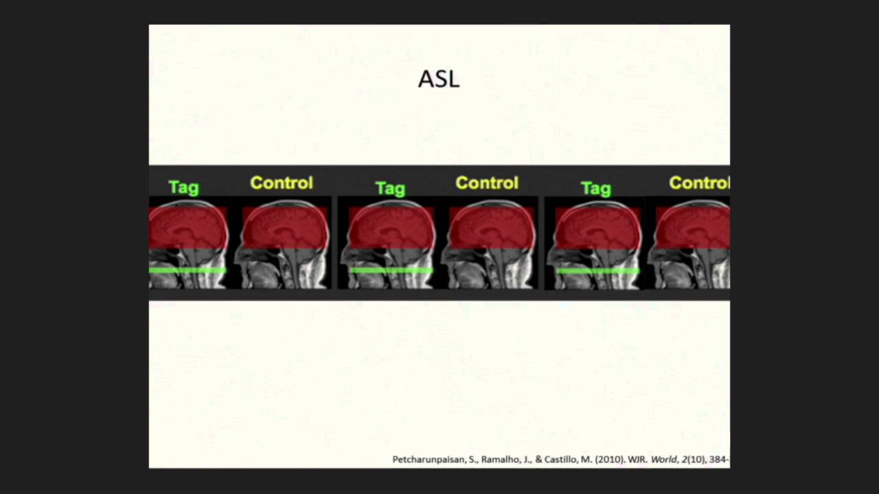 Giann Paolo Coria Bustos Flores-39
