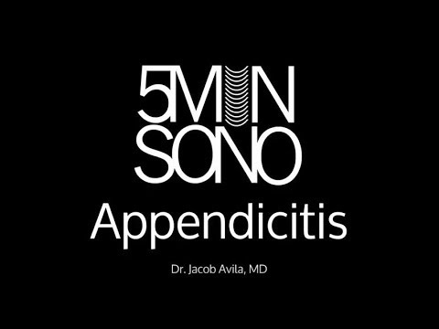 Ultrasound to Diagnose Appendicitis