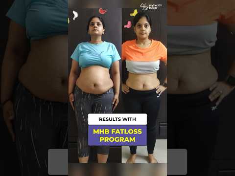 75 kgs - 70 kgs | BELLY FATLOSS in 3 months 🔥