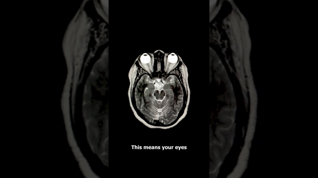 Creepy MRI Images EXPLAINED 😱 (spooky)