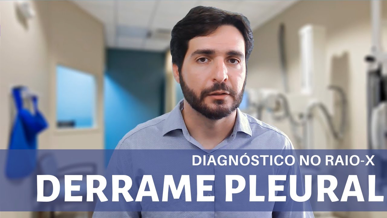 Derrame Pleural: aprenda a identificar passo-a-passo no Raio-X de Tórax | Galvani Filho