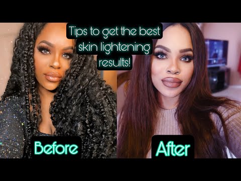 Reasons you might not be seeing results in your skin Lightening Journey