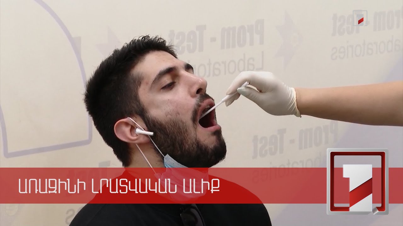 Նոր կանոններ. չպատվաստված աշխատողները ՊՇՌ թեստ պետք է ներկայացնեն ամենշաբաթյա պարբերականությամբ