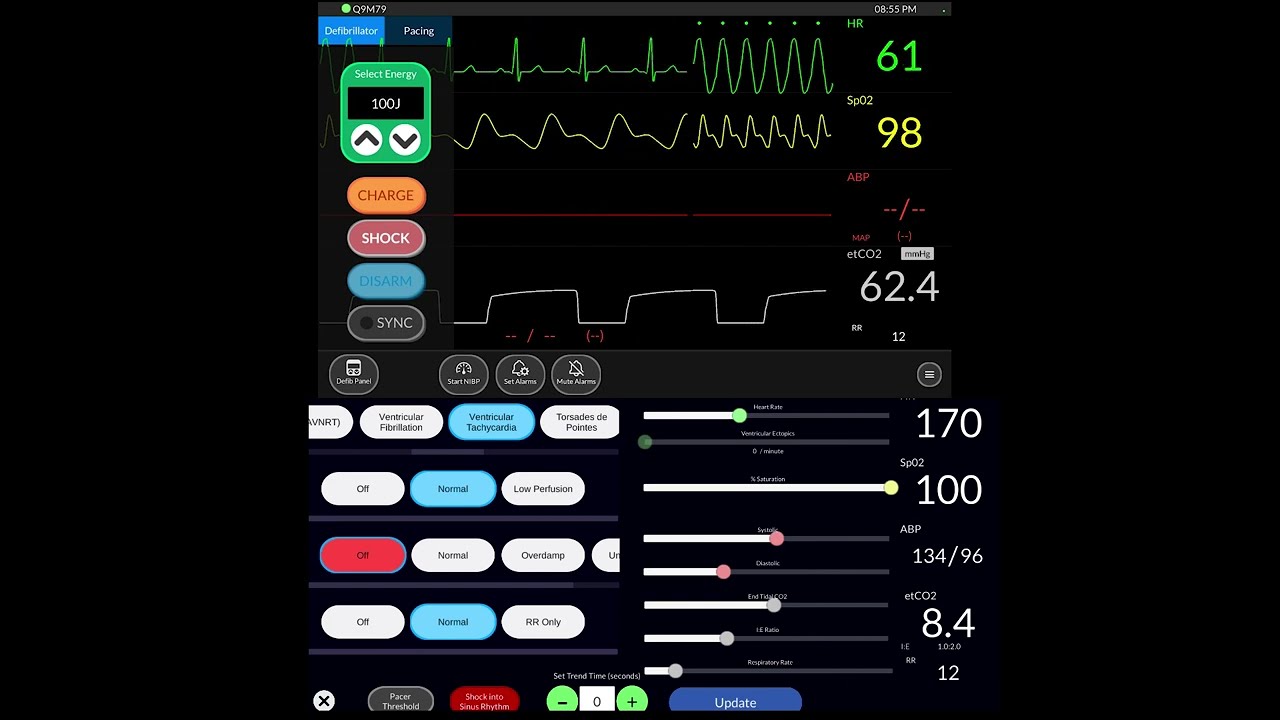 Simpl patient monitor APP demonstration (How to use simple monitor app)