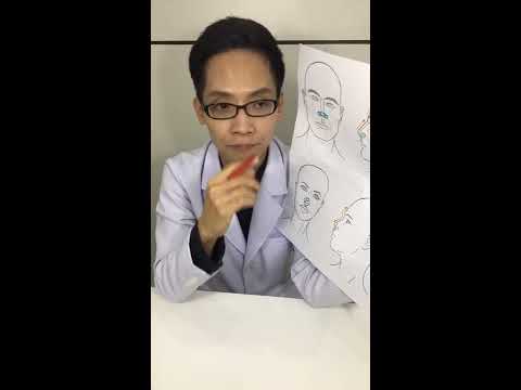 Belosalik และความแข็งแรง สมาชิกแหวนเพิ่ม
