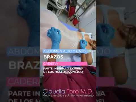 Moldea tu figura con criolipólisis - Dra. Claudia Toro médica estética y antienvejecimiento Bogotá