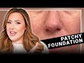 7 Reasons Why Your Foundation Looks PATCHY Tiktok Didn T Teach You These