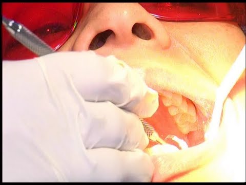 দাঁত সুস্থ রাখতে হলে যত্ন জরুরী