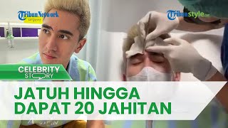 Verrel Bramasta Mendadak Bagikan Kabar Tak Menyenangkan, Sang Aktor Sebut Alami Insiden Jatuh