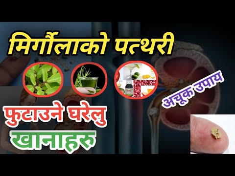 मिर्गौला को पत्थरी फुटाउने खानाहरु home remedies of kidney stone || Nepali Health Tips