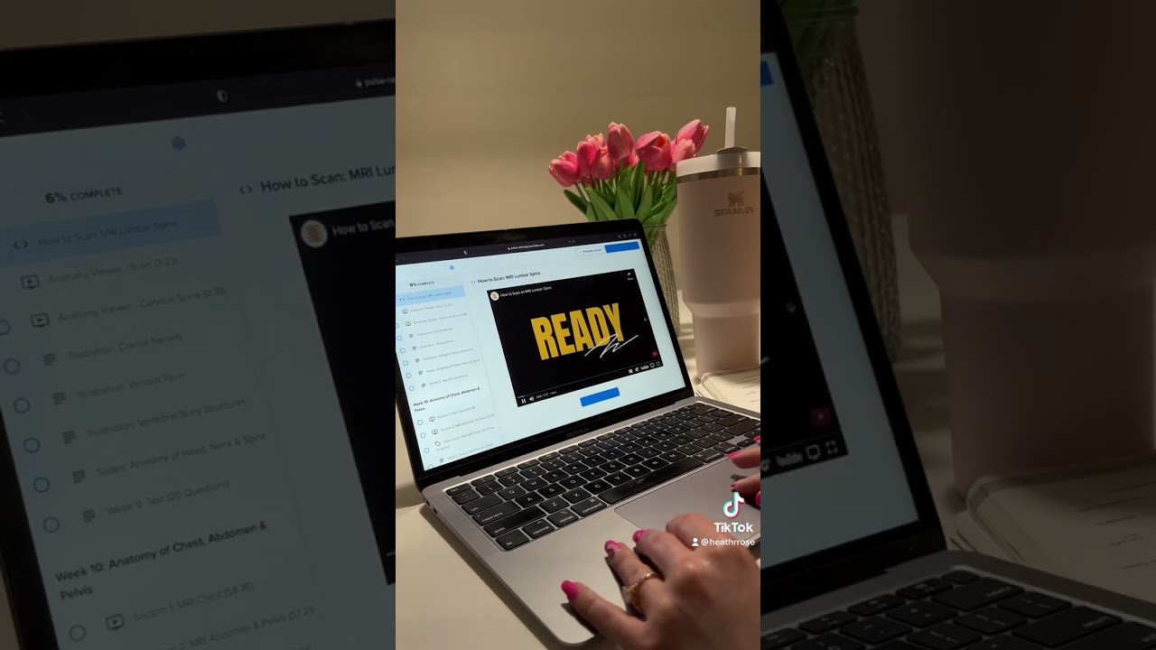 What is it like as a Pulse Radiology Student?