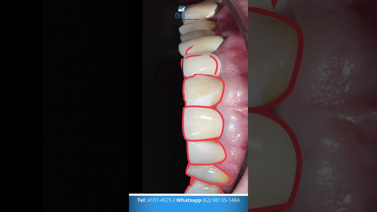 Danilo Monteiro Rezende Pereira-30