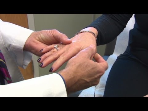 Living with Rheumatoid Arthritis