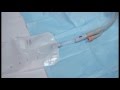 How To Change A Supra Pubic Catheter