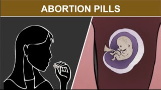 1st Trimester Medical Abortion: Abortion Pills
