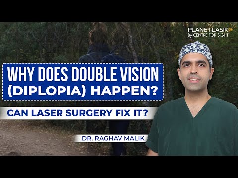 Can Refractive Surgery Correct Double Vision? | Dr. Raghav Malik | Planet LASIK