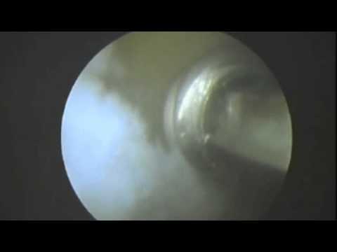 Psicosomatica articolazione del pollice sulla mano Se molto mal di schiena che si può fare