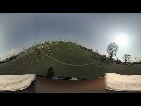 アメリカンフットボールでも使える:PupilScreenは脳損傷を診断するアプリ