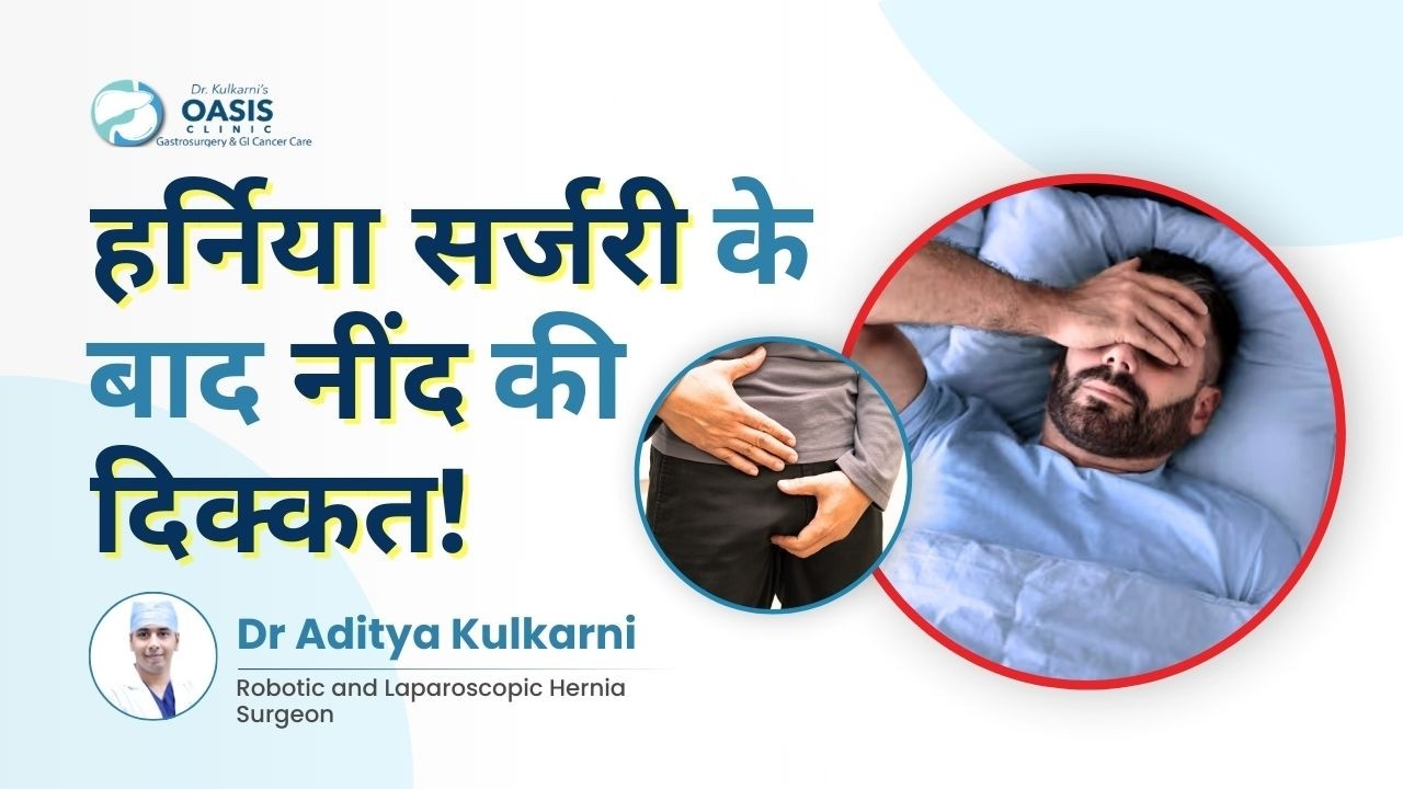हर्निया ऑपरेशन के बाद कैसे सोएं? | Can Hernia Mesh Surgery Affect Sleep? |  Dr Aditya Kulkarni