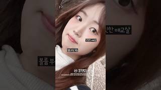애교필러, 입술필러 직후 효과