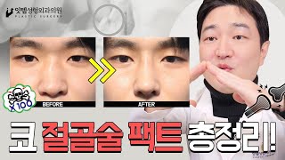 이래도 절골이 효과가 없다고? 코성형 절골술 팩트 총정리!