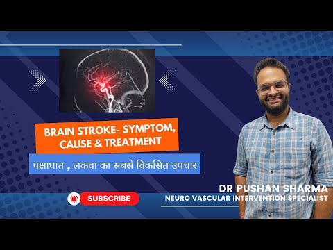 Stroke- most advanced |Dr. Pushan Sharma | Neuro Vascular Intervention - Uttarpradesh 