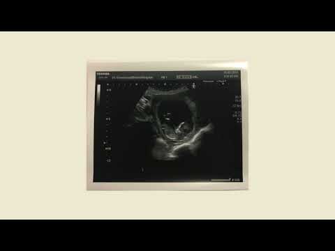 Danny Thomas - I Swear (About To Be A Dad)