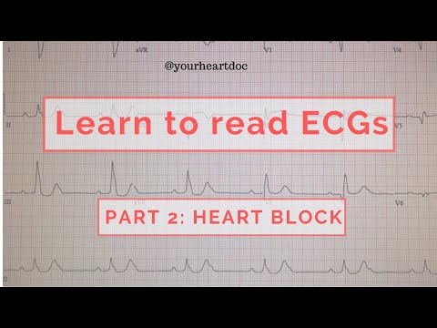 How to read an ECG / EKG Part 2: Heart Block
