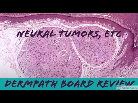Nerve Sheath Tumors, etc: Dermpath Board Review (25 cases in 1.5 hours) for Dermatology & Pathology
