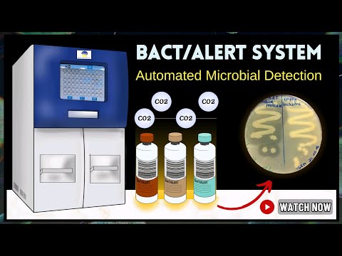 BacT/ALERT System: Fast Detection of Bacteria, Fungi, Sepsis, & Infections | Complete Workflow Guide