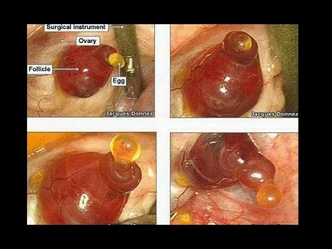 Potensi gym Apakah kacang dengan madu membantu untuk potensi