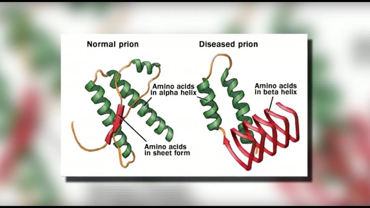 CJD Creutzfeldt-Jakob Disease - Mayo Clinic