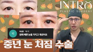 중년눈수술은 자연스럽게 하는게 좋습니다