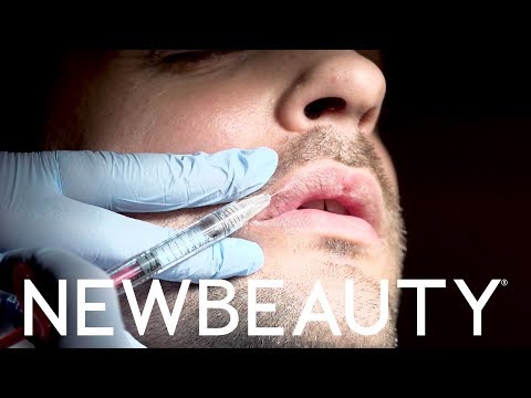 What It Was Like To Get Lip Fillers For The First Time | NewBeauty