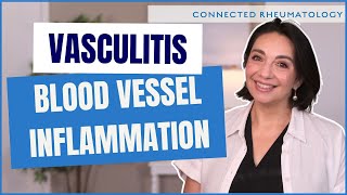 What is Vasculitis Learn about this rare, but deadly autoimmune disease