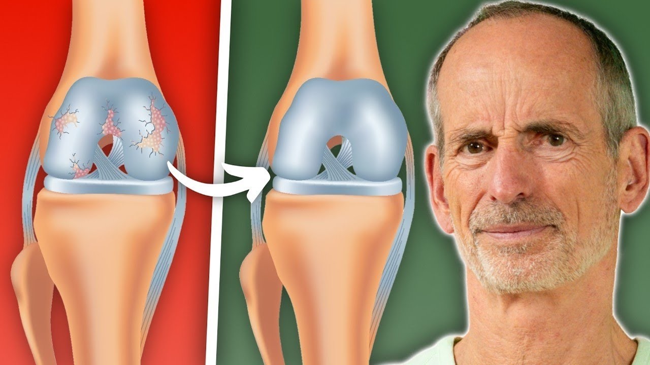 Die Wahrheit über Arthrose: Wie man sie wirklich los wird