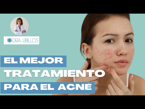 EL MEJOR TRATAMIENTO PARA EL ACNÉ