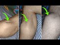 Why Your Legs Cramp At Night And How To Keep It From Happening Again