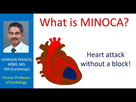 What is MINOCA? Heart attack without a block!