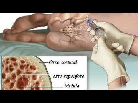 download lagu mp3 mp4 Doar Medula Ossea, download lagu Doar Medula Ossea gratis, unduh video klip Doar Medula Ossea