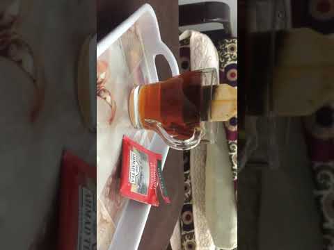 وصفة لتشققات الكعبين