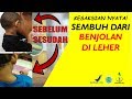 Sembuh Dari Benjolan di Leher || REAL TESTIMONI QnC Jelly Gamat Menyembuhkan Benjolan di Leher Sembuh Dari Benjolan di Leher || REAL TESTIMONI QnC Jelly Gamat Menyembuhkan Benjolan di Leher