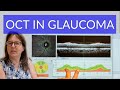 Using OCT in Glaucoma - Tutorial for Beginners
