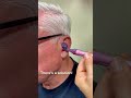 The Completely In Canal Hearing Aid Is Close To Invisible Oddlysatisfying Rochesterny Audiology